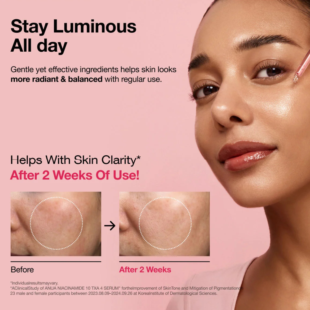 Anua Niacinamide 10% + TXA 4% Serum, Before and After reduction in pigmentation and increase of skin clarity after 2 weeks of use