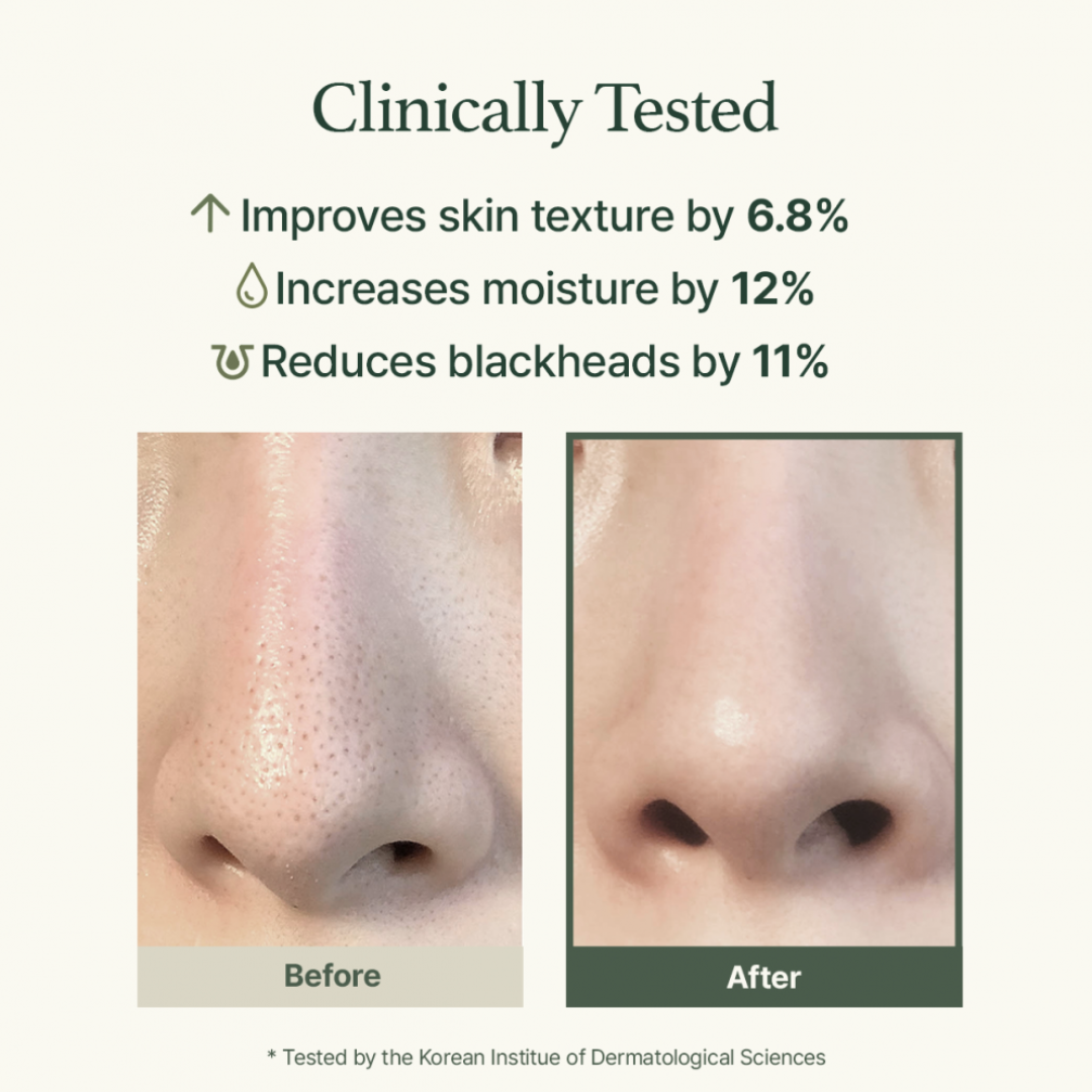 Before and after comparison of skin texture improvement with clinical testing results after using Arencia Fresh Green Rice Mochi Cleanser