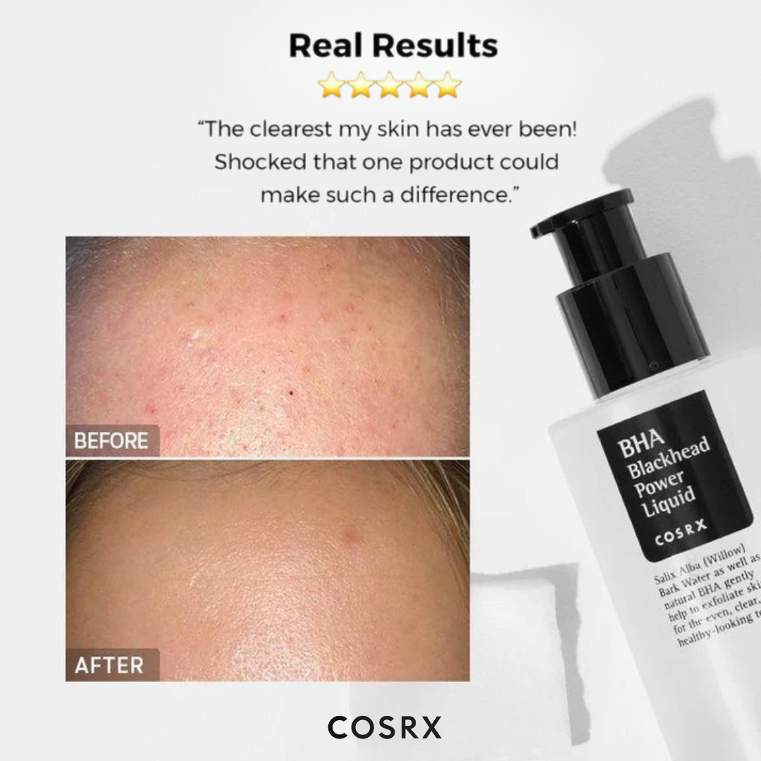 Cosrx BHA Blackhead Power Liquid with before and after skin comparison