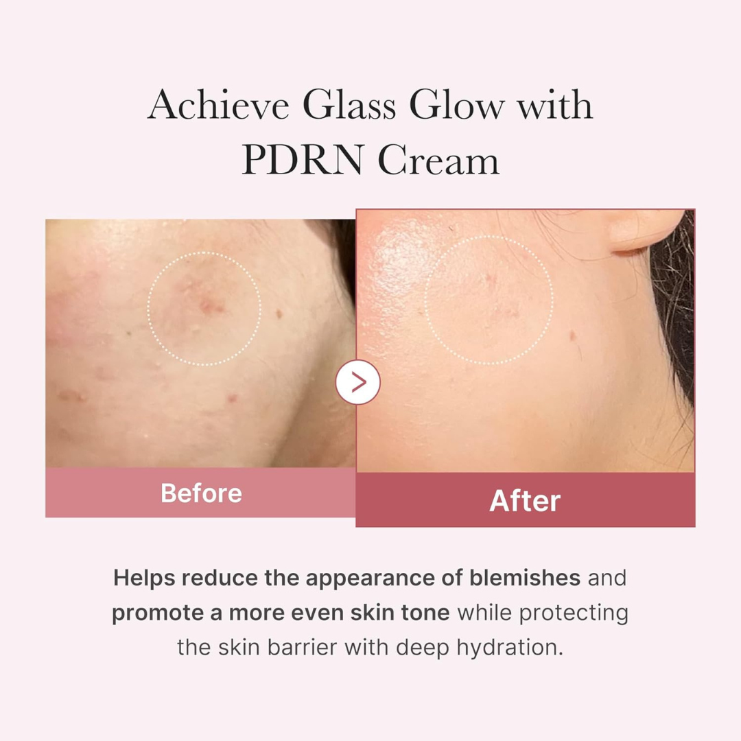 Before and after comparison of Medicube PDRN Hyaluronic Moisturizing Cream on skin with text about its benefits.