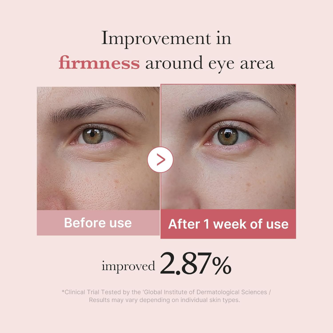 Before and after comparison of eye area firmness improvement with text indicating results. Medicube PDRN Pink Peptide Eye Cream