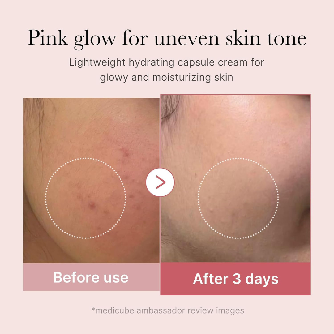 Before and after comparison of skin tone improvement with Medicube PDRN Pink Collagen Capsule Cream, showing an improvement in skin tone.