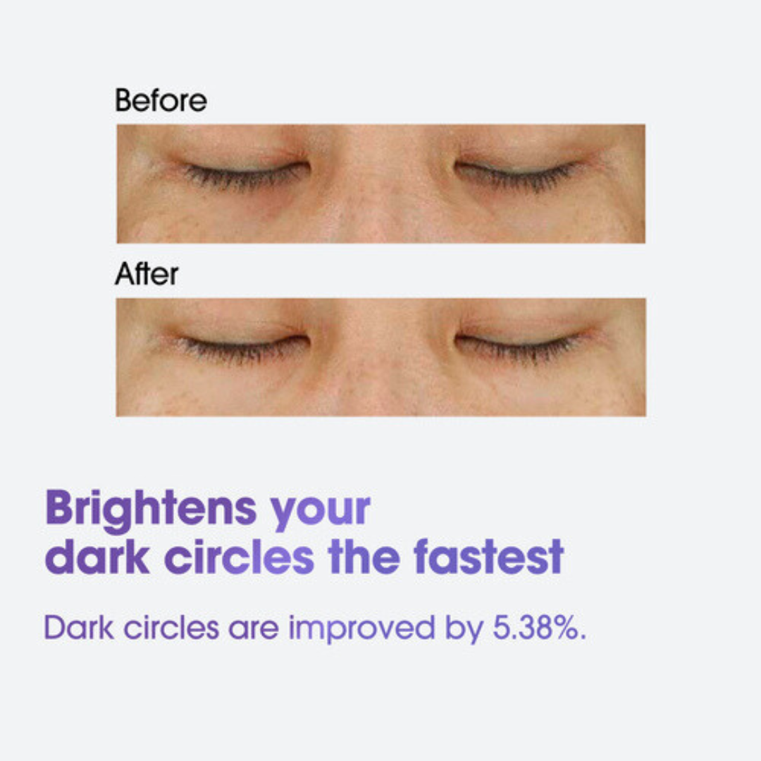 Before and after comparison of dark circles with text indicating improvement. SOME BY MI Retinol Intense Advanced Triple Action Eye Cream