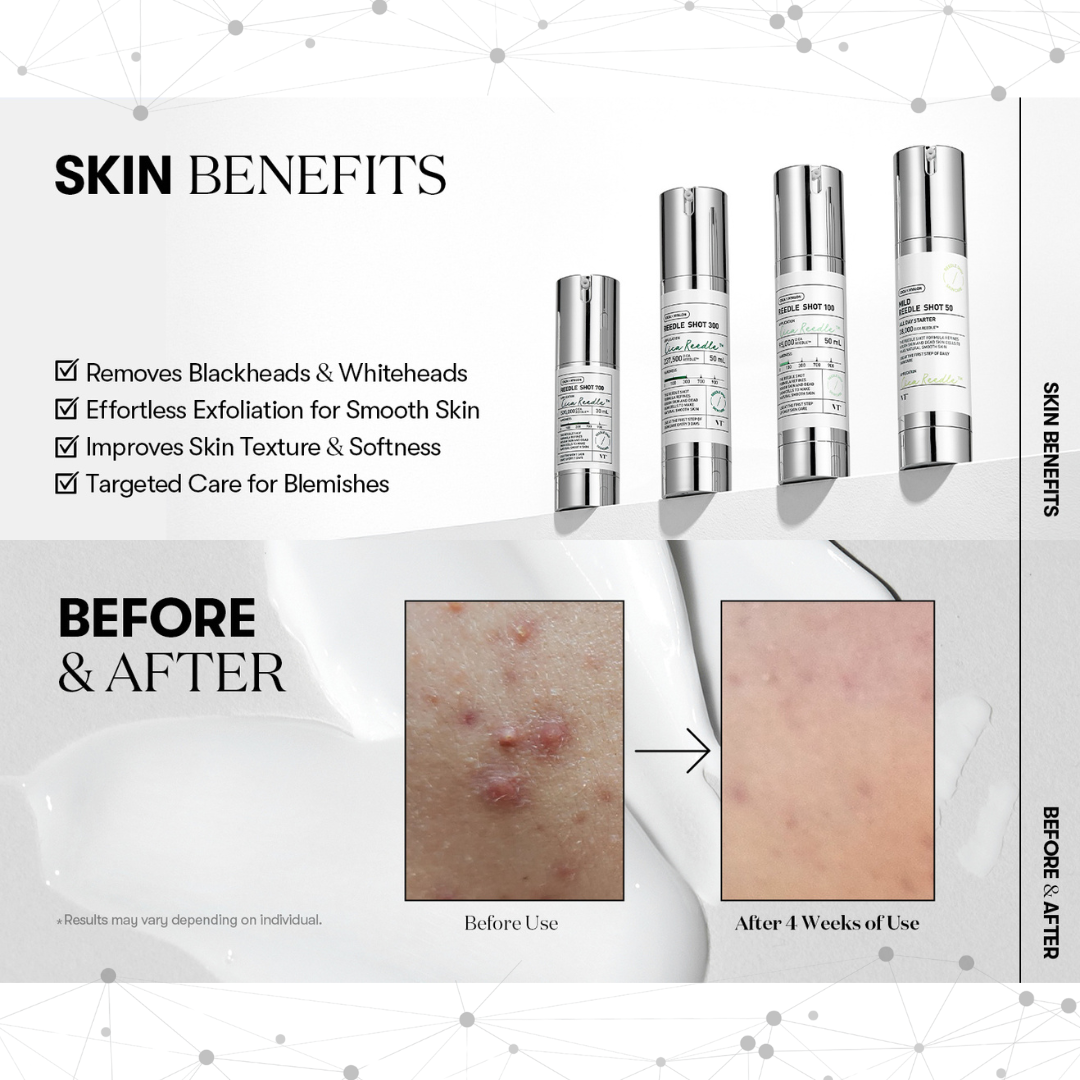 VT Cosmetics Reedle Shot 100 with before and after effects on skin.