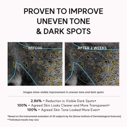 Before and after comparison of skin with dark spots, showing improvement over 2 weeks of use of the ARENCIA TXA Booster Shot.