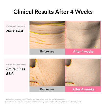 Before and after clinical results of Abib PDRN Volume Fill-It Booster Cream 2.5 Tube on neck and smile lines after 4 weeks.