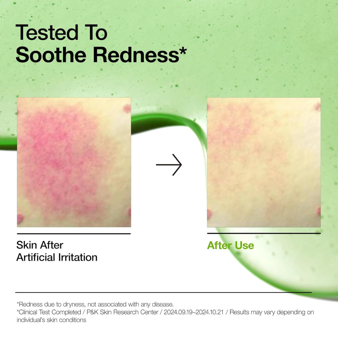Before and after comparison of skin redness with a green background and text about soothing redness. Anua Azelaic Acid 10 Hyaluron Redness Soothing Serum