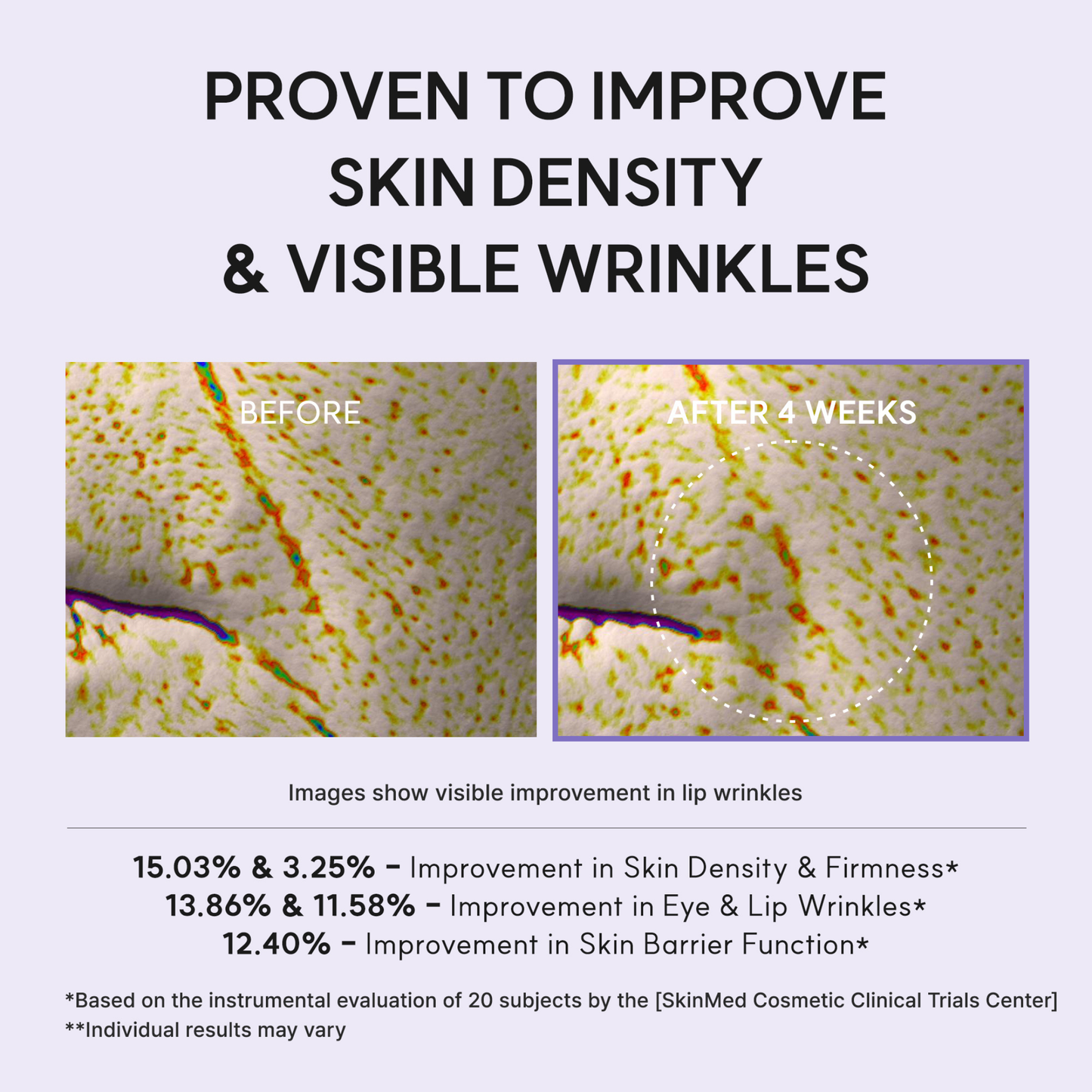 Promotional graphic for the ARENCIA NAD+ Booster Shot with text reading 'PROVEN TO IMPROVE SKIN DENSITY & VISIBLE WRINKLES,' two close-up before/after skin texture panels labeled 'BEFORE' and 'AFTER 4 WEEKS,' and percentage improvement claims below.