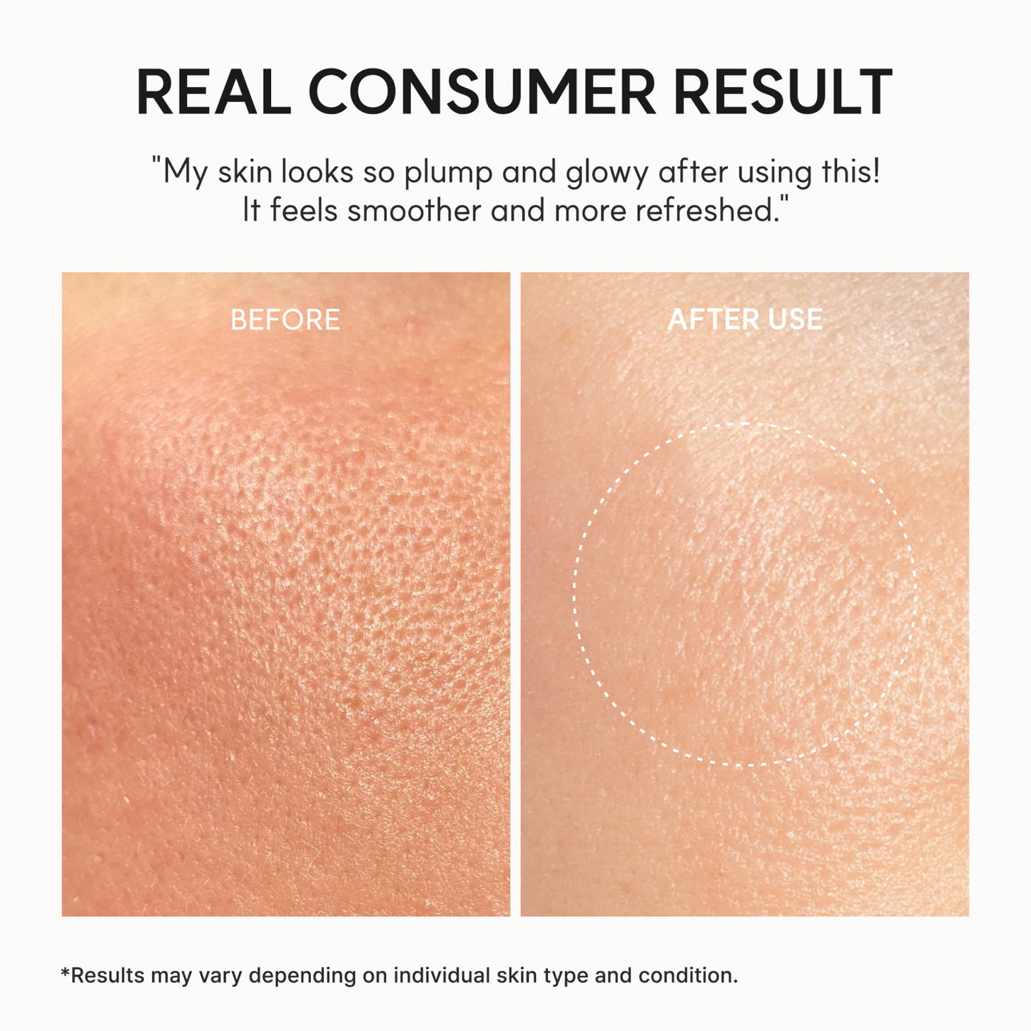Before and after skin texture comparison with text indicating consumer results. Results were obtained after the use of the ARENCIA NAD+ Booster Shot.