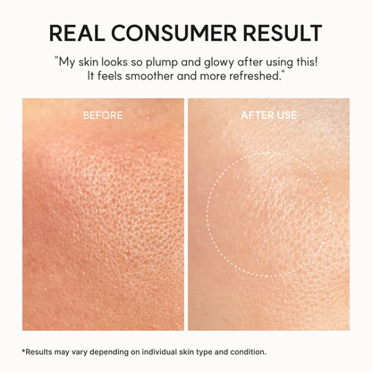 Before and after skin texture comparison with text indicating consumer results. Results were obtained after the use of the ARENCIA NAD+ Booster Shot.