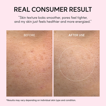 A before-and-after skin texture comparison on a light pink background. The top text reads 'REAL CONSUMER RESULT' with a quote about smoother skin and healthier skin texture. The results were obtained after the use of the ARENCIA PDRN Booster Shot