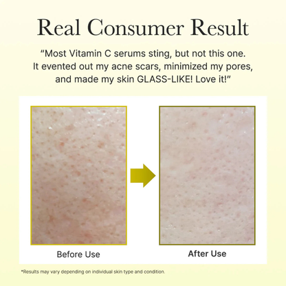 Before and after skin comparison with text about Arencia Vitamin C Booster Shot's effectiveness.
