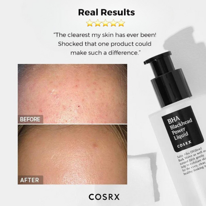 Cosrx BHA Blackhead Power Liquid with before and after skin comparison