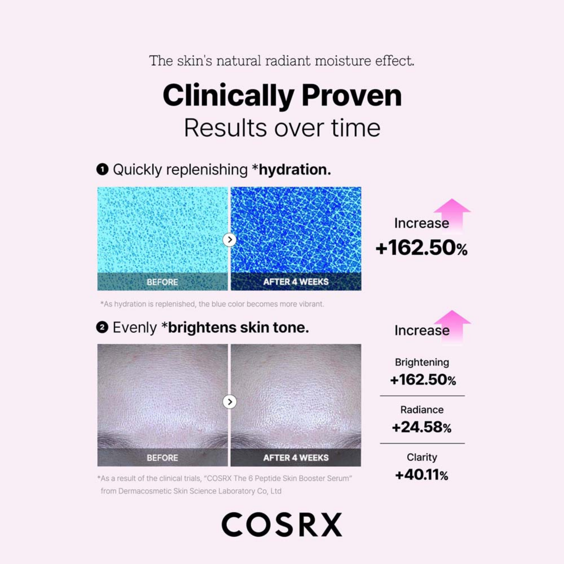 Hydration and skin tone improvement over time with before and after images after using COSRX The 6 Peptide Skin Booster for 4 weeks.
