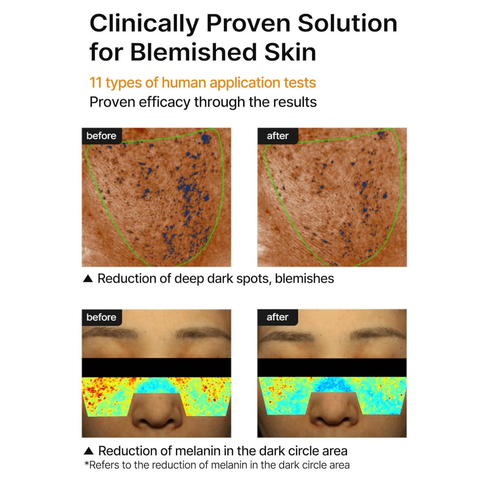 Celimax Pore+Dark Spot Brightening Cream clinical results showing efficacy on deep, dark spots as well as melanin reduction