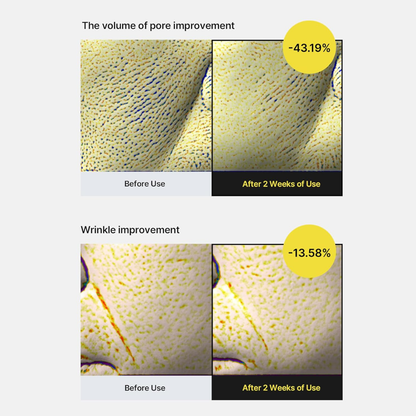 Before and after comparison of pore and wrinkle improvement with usage, shown on a white background. Celimax The Vita A Retinol Shot Tightening Serum