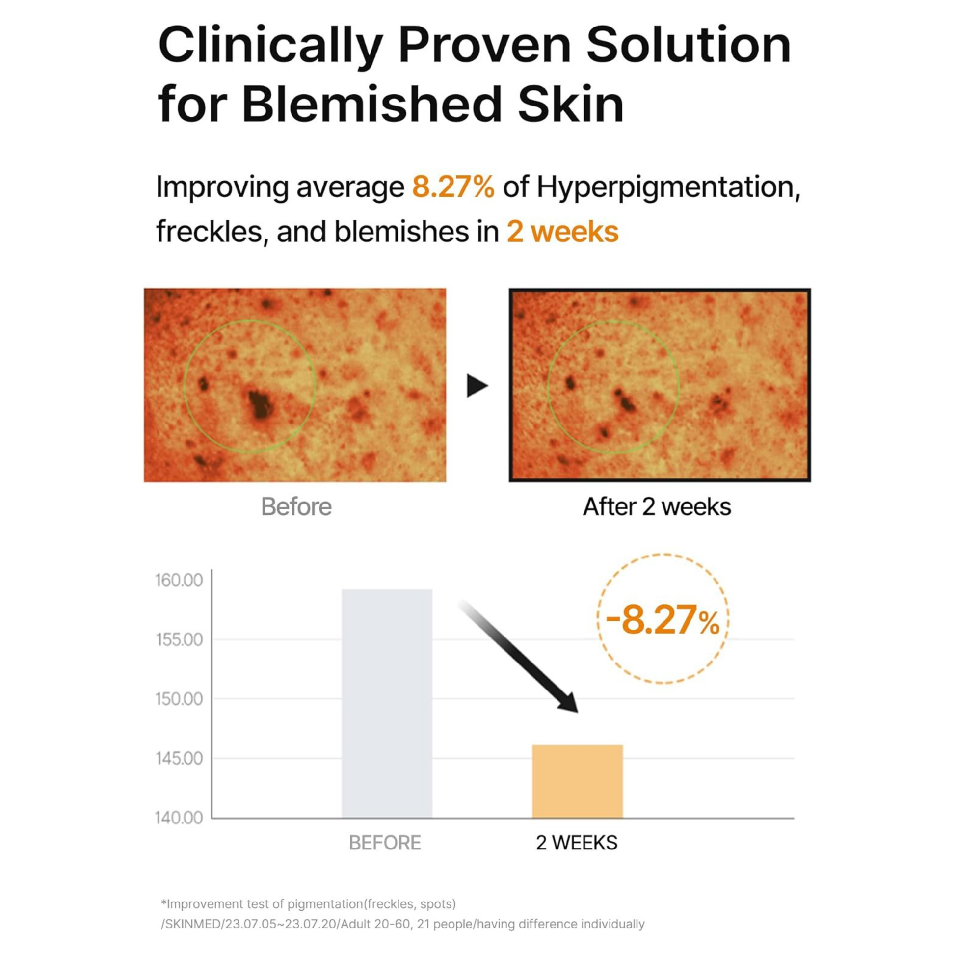 Information on a clinically proven solution for blemished skin with before and after images and a graph showing improvement of hyperpigmentation, freckles and blemished when using Celimax Pore+Dark Spot Brightening Pad. 