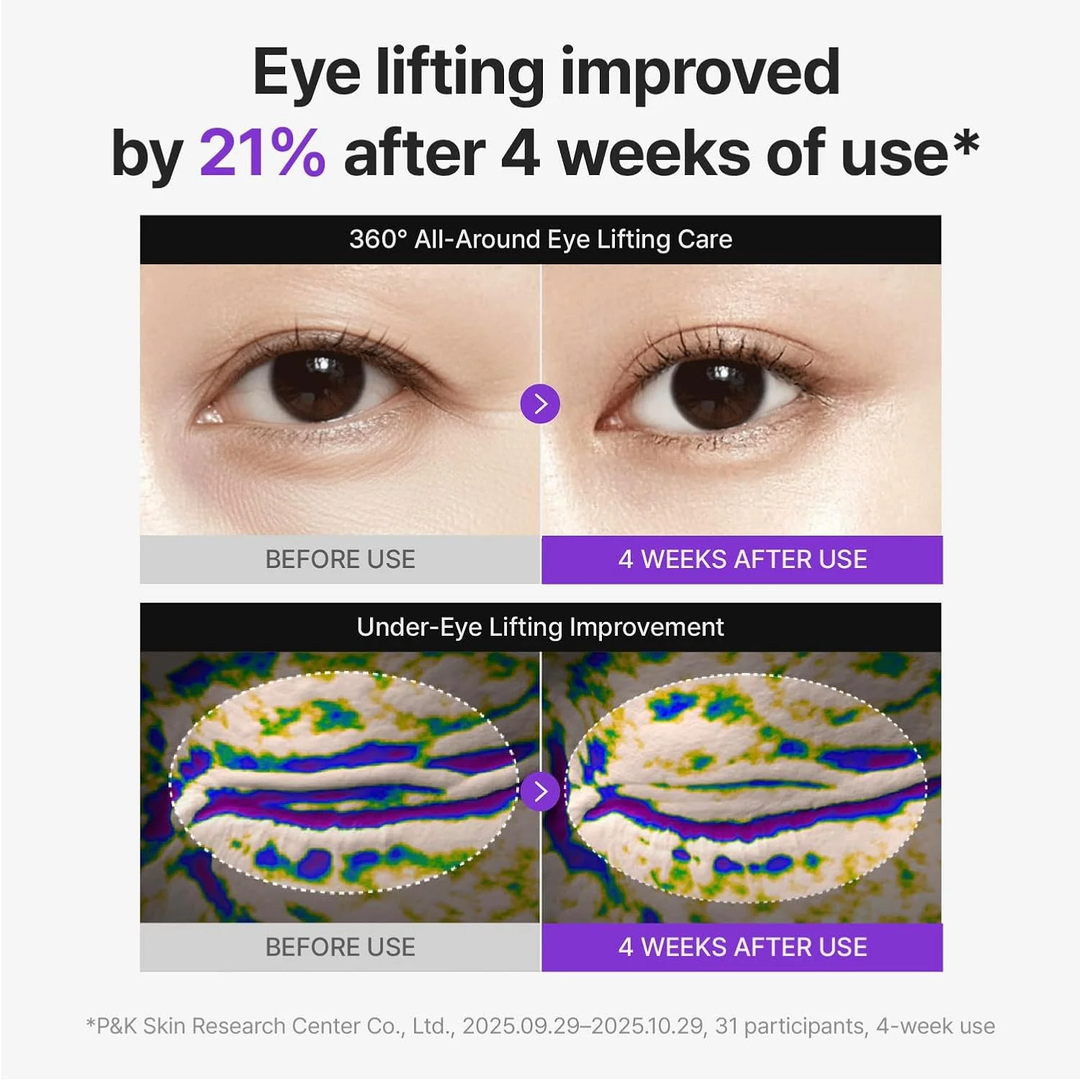 Centellian24 360º Shot PDRN Lifting Eye Cream clinical results showing eye lifting improved by 21 percent after 4 weeks of use.