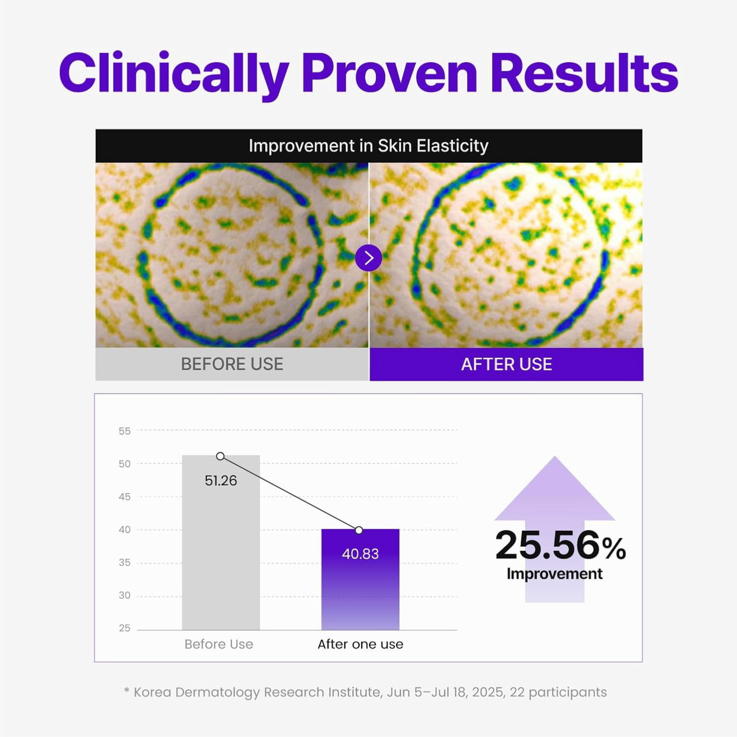 Before and after use comparison of elasticity improvement after the use of Centellian24 Expert Madeca Cream Active Renew PDRN with clinical research data results.