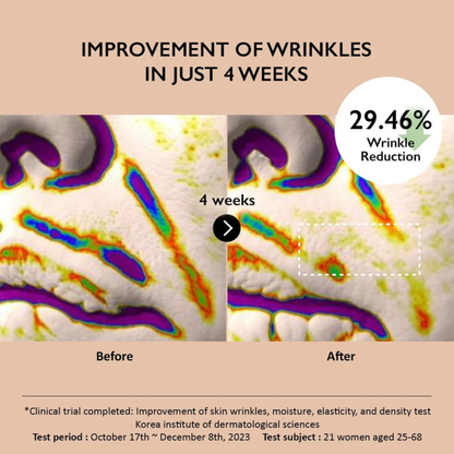 Before and after comparison of skin wrinkles with wrinkle reduction percentage shown. Results are after 4 weeks of use of Haruharu Wonder Centella Phyto & 5 Peptide Concentrate Cream