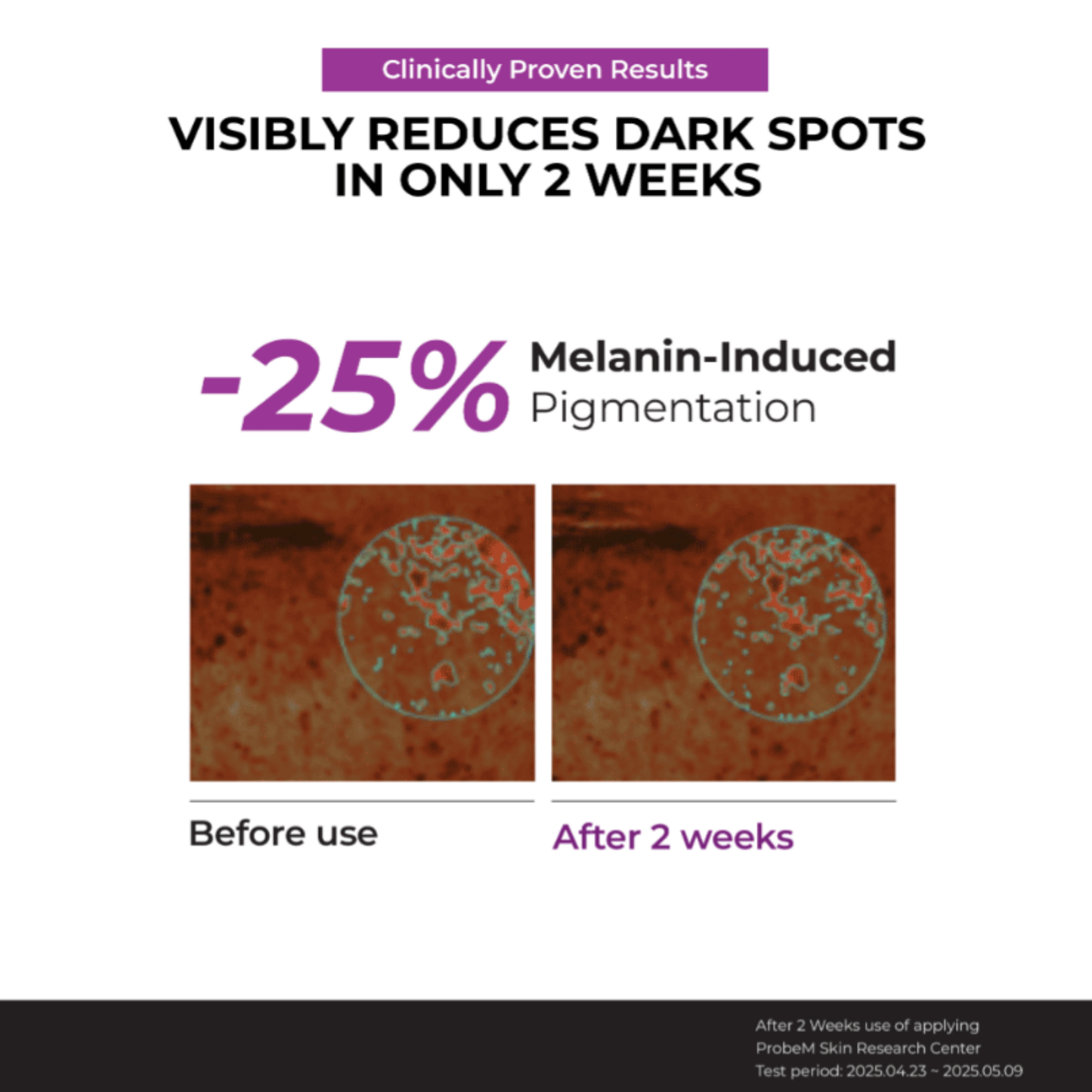 Clinical results featuring Before and after effects of JUMISO Niacinamide 20 Serum on melanin-induced pigmentation.