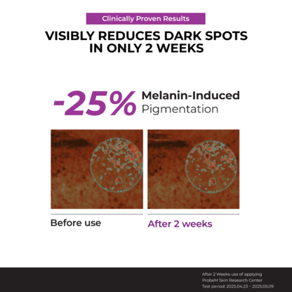 Clinical results featuring Before and after effects of JUMISO Niacinamide 20 Serum on melanin-induced pigmentation.