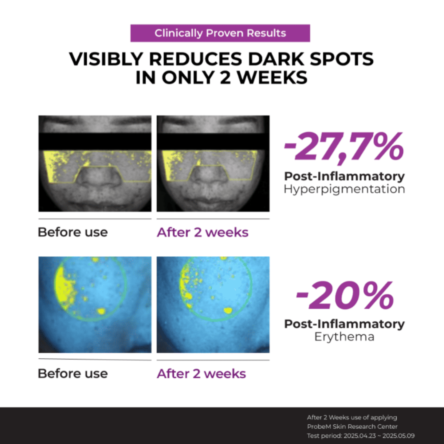 Clinical results featuring Before and after images of JUMISO Niacinamide 20 Serum reducing dark spots.