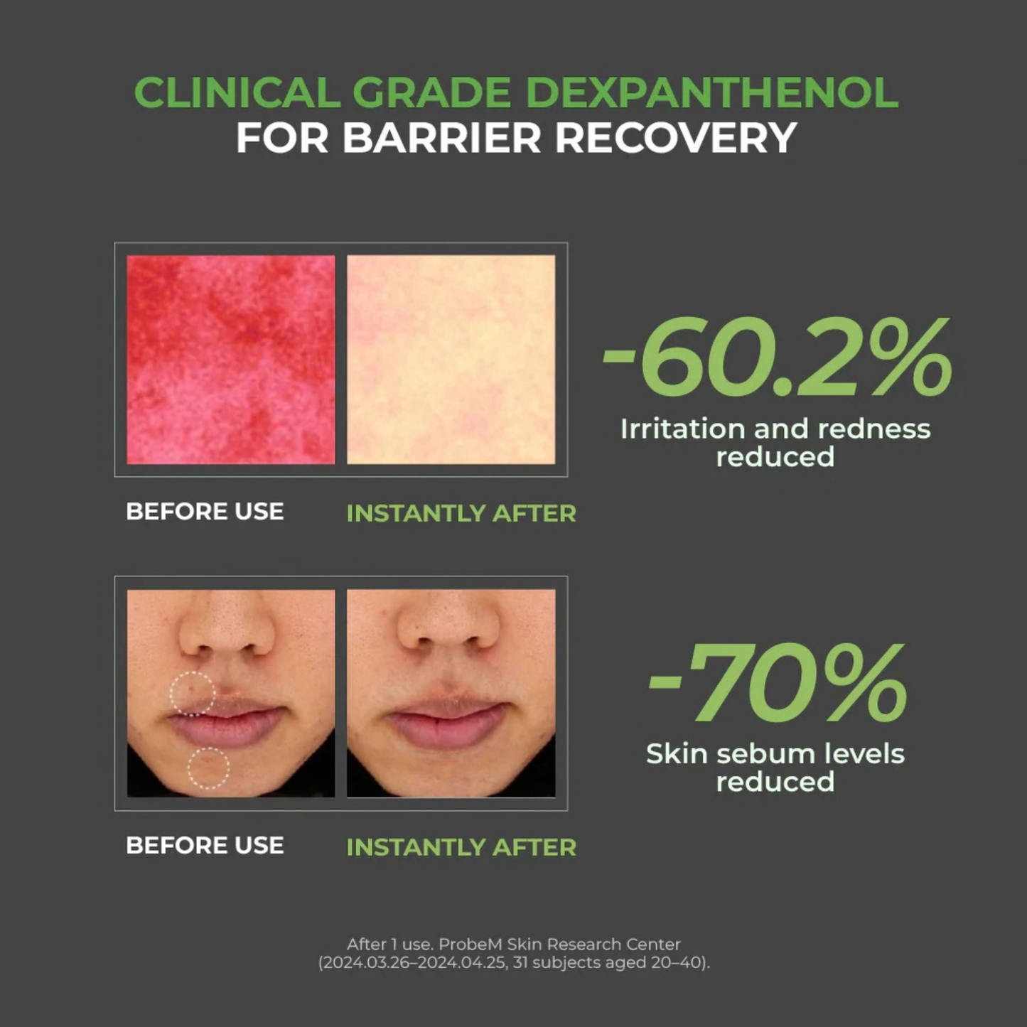 Clinical results after 1 use of the Jumiso D-Panthenol Barrier Soothing Cream with before and after skin condition improvements on a dark background.