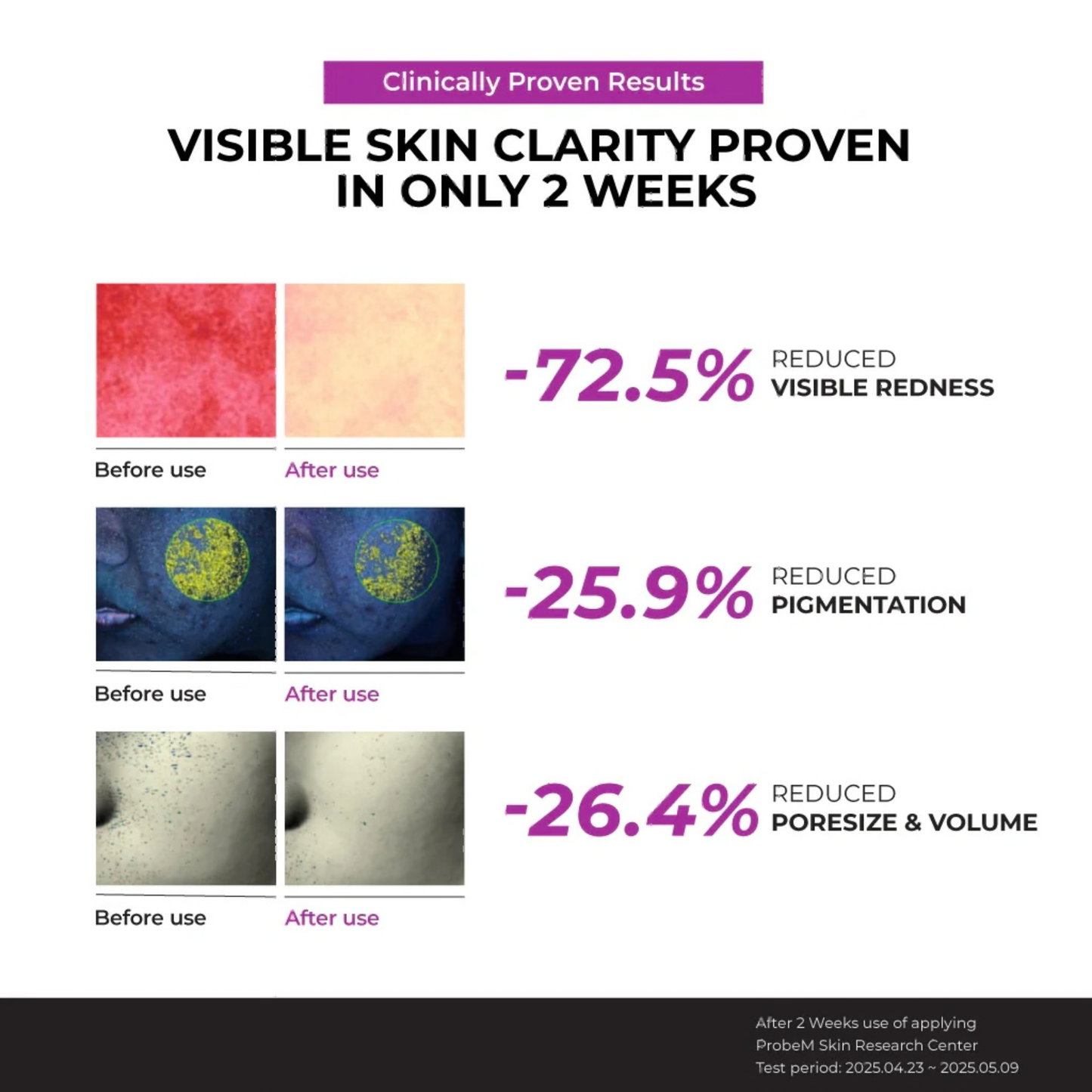Clinically proven skin clarity results with before and after images and statistics obtained after 2 weeks of using the Jumiso Niacinamide 10 Serum