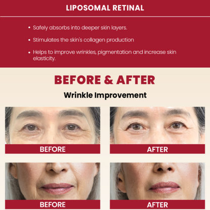 Before and after effects of liposomal retinal on skin with wrinkle improvement. K-SECRET Seoul 1988 Cream: Retinal Liposome 1% + Fermented Rice