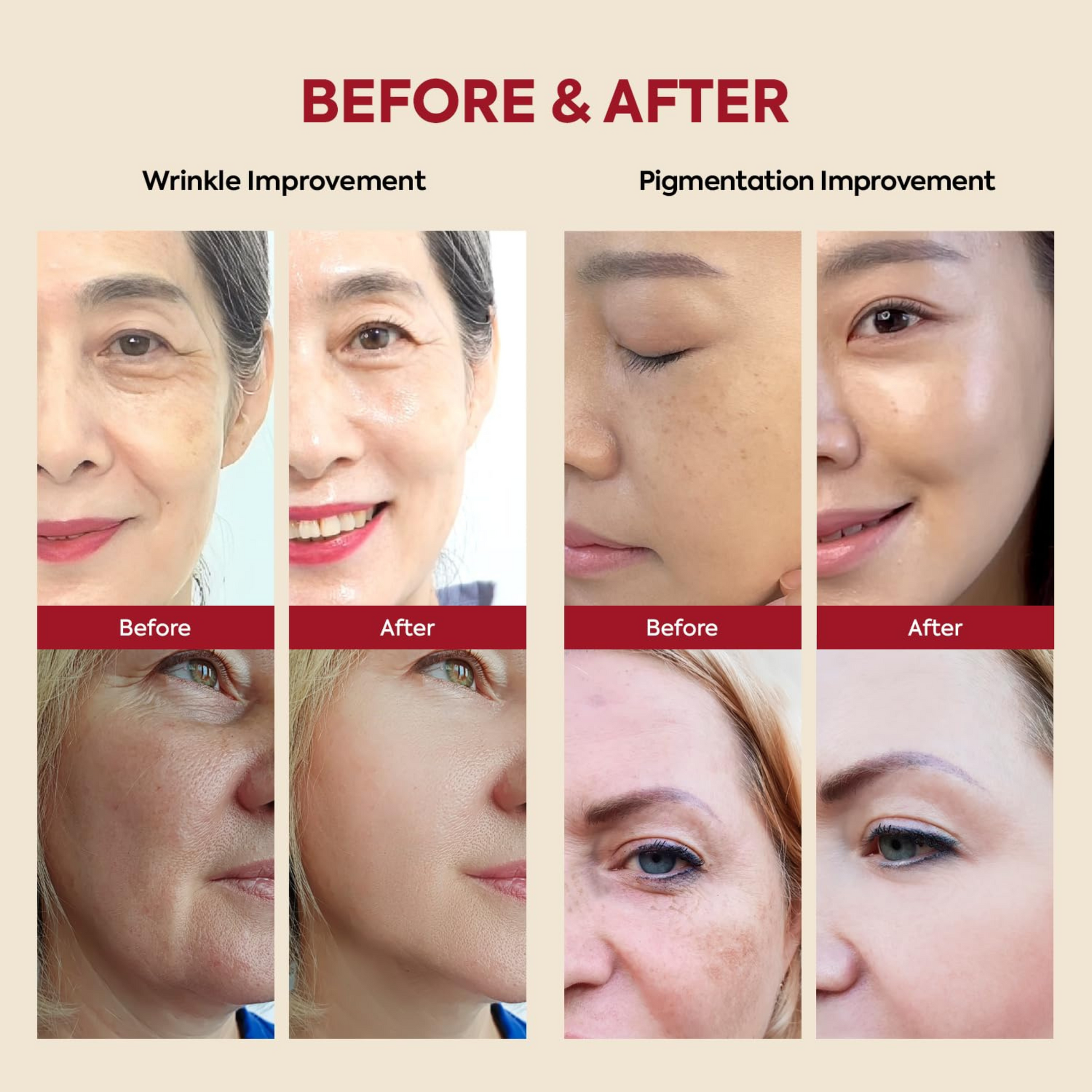 Before and after comparison of wrinkle and pigmentation improvement on faces. K-Secret SEOUL 1988 Serum: Retinal Liposome 2% + Black Ginseng