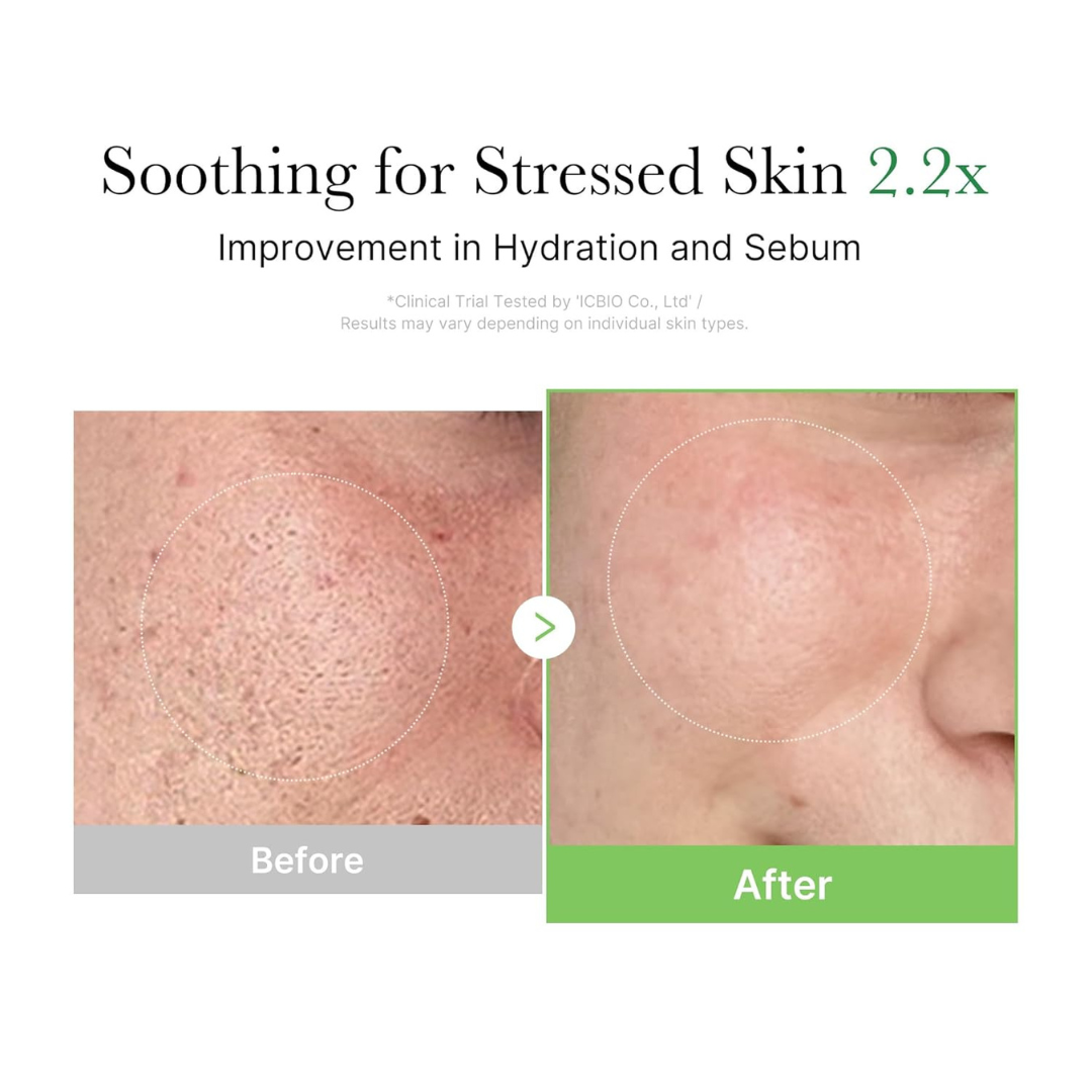 Before and after comparison of stressed skin with text indicating improvement in hydration and sebum. Medicube Exosome Cica Cream
