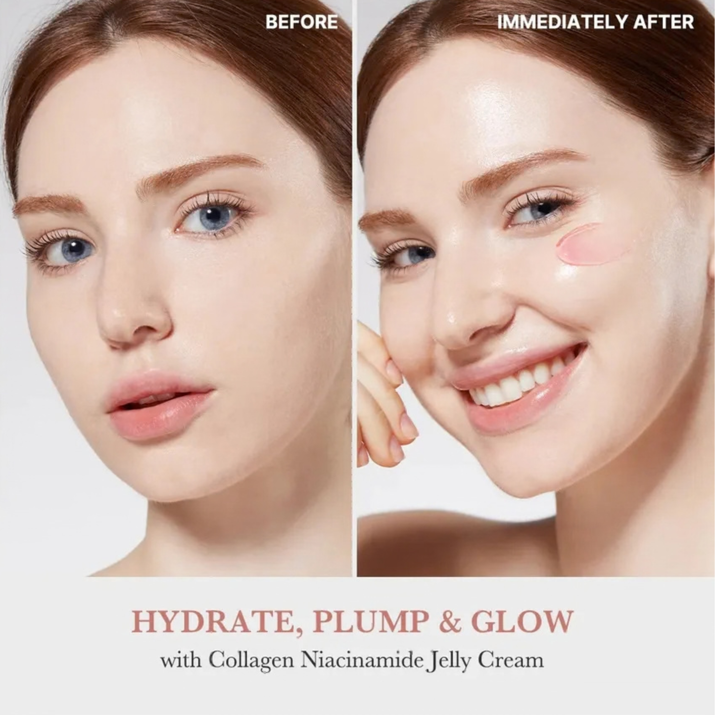 Before and after comparison of a woman's face after using the Medicube Collagen Jelly Cream with text 'Hydrate, Plump & Glow'.