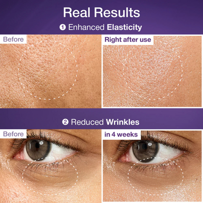 Before and after effects of Numbuzin No.9 NAD Bio Lifting Essence on skin elasticity and wrinkles.