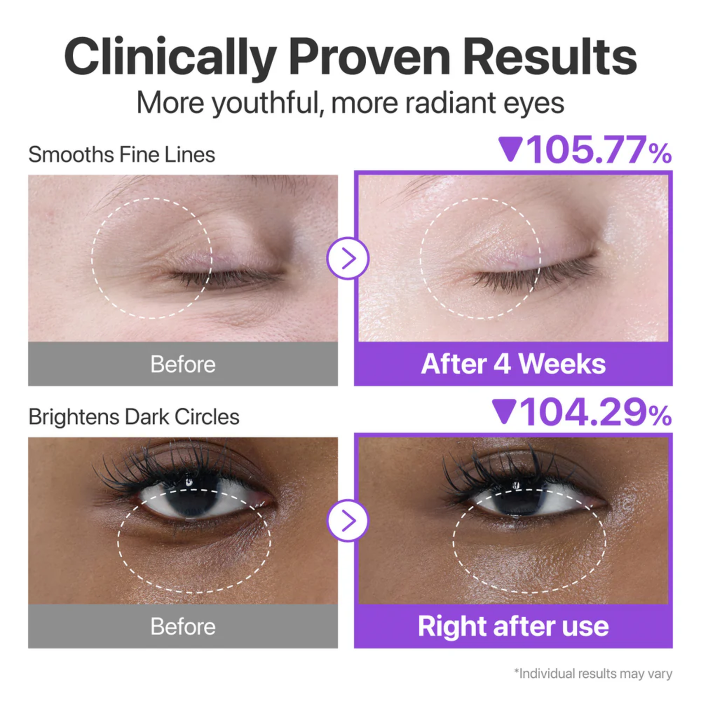 Numbuzin No.9 NAD+ Retinol Volumetox Eye Cream clinically proven results showing a difference in eye wrinkles and hollowness under eyes