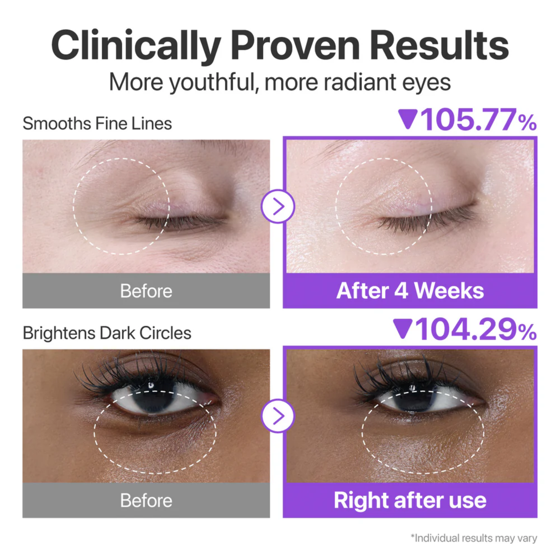 Numbuzin No.9 NAD+ Retinol Volumetox Eye Cream clinically proven results showing a difference in eye wrinkles and hollowness under eyes