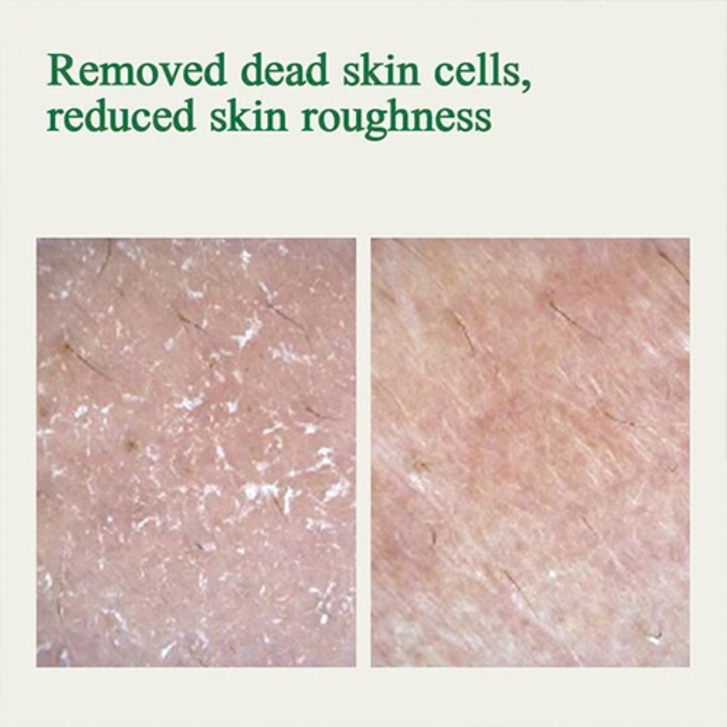 Before and after comparison of results achieved of skin texture improvement after using the Pyunkang Yul Ultimate Calming Solution Ampoule with text indicating removed dead skin cells and reduced skin roughness.