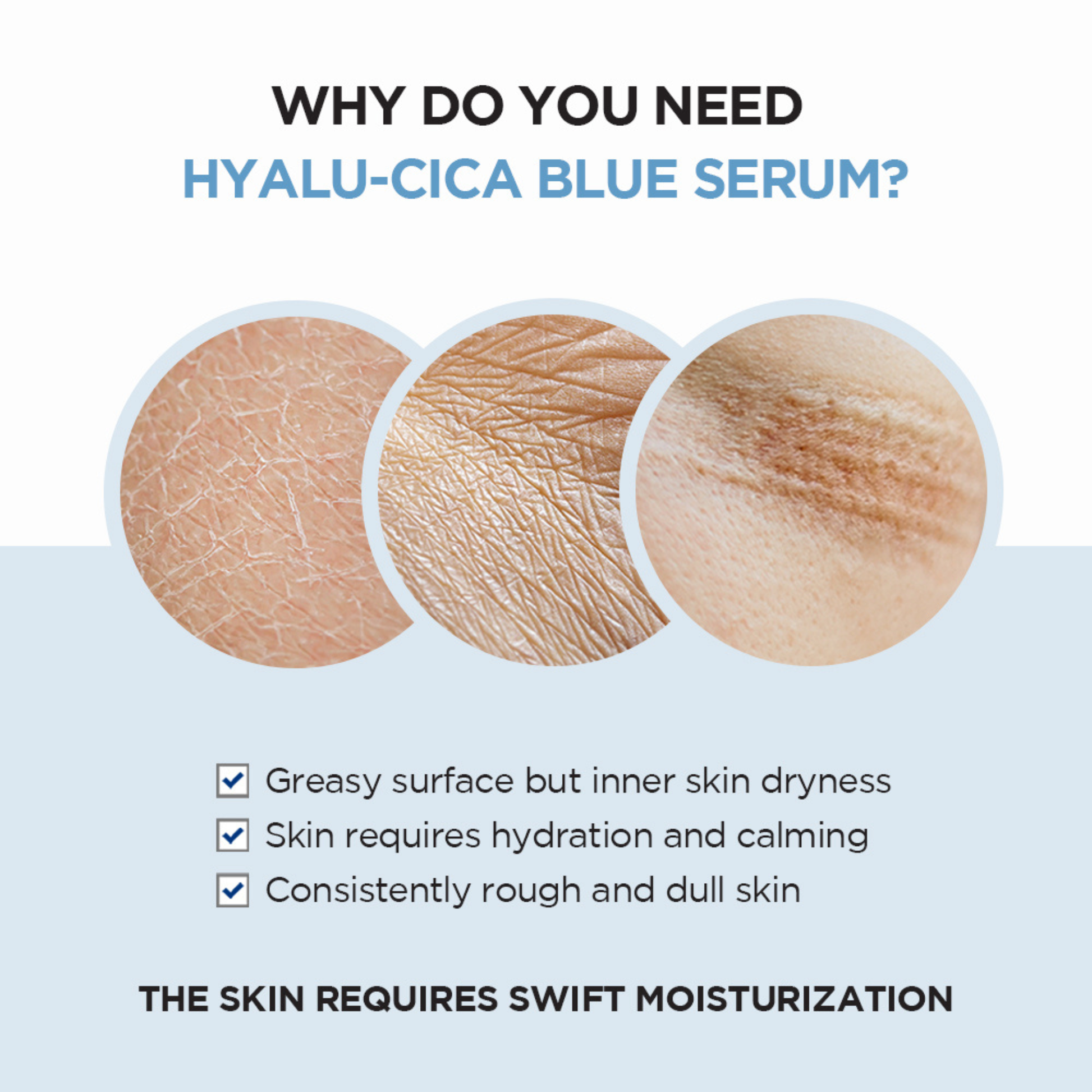 SKIN1004 Hyalu-Cica Blue Serum - information on the benefits of the product with pictures of dry, cracked and wrinkly skin