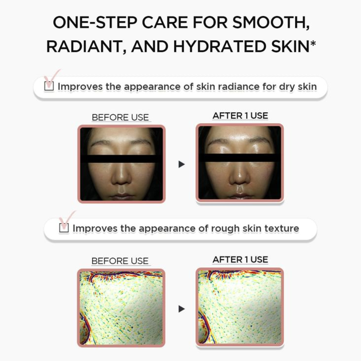 SKIN1004 Madagascar Centella PDRN 1.5 Cream clinical before-and-after infographic showing skin radiance and rough texture improvements. The top text reads 'ONE-STEP CARE FOR SMOOTH, RADIANT, AND HYDRATED SKIN'.