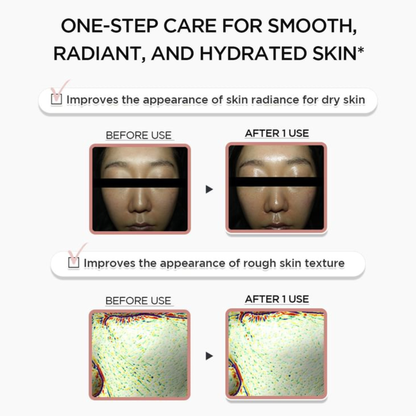 SKIN1004 Madagascar Centella PDRN 1.5 Cream clinical before-and-after infographic showing skin radiance and rough texture improvements. The top text reads 'ONE-STEP CARE FOR SMOOTH, RADIANT, AND HYDRATED SKIN'.