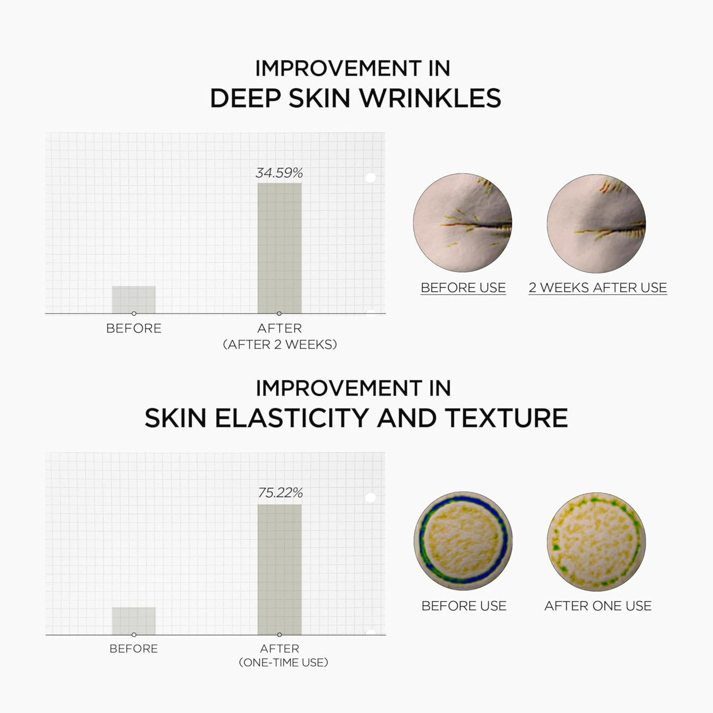 Before and after effects of SKIN1004 Madagascar Centella Retinol 0.2 Boosting Shot Ampoule on skin wrinkles and elasticity.