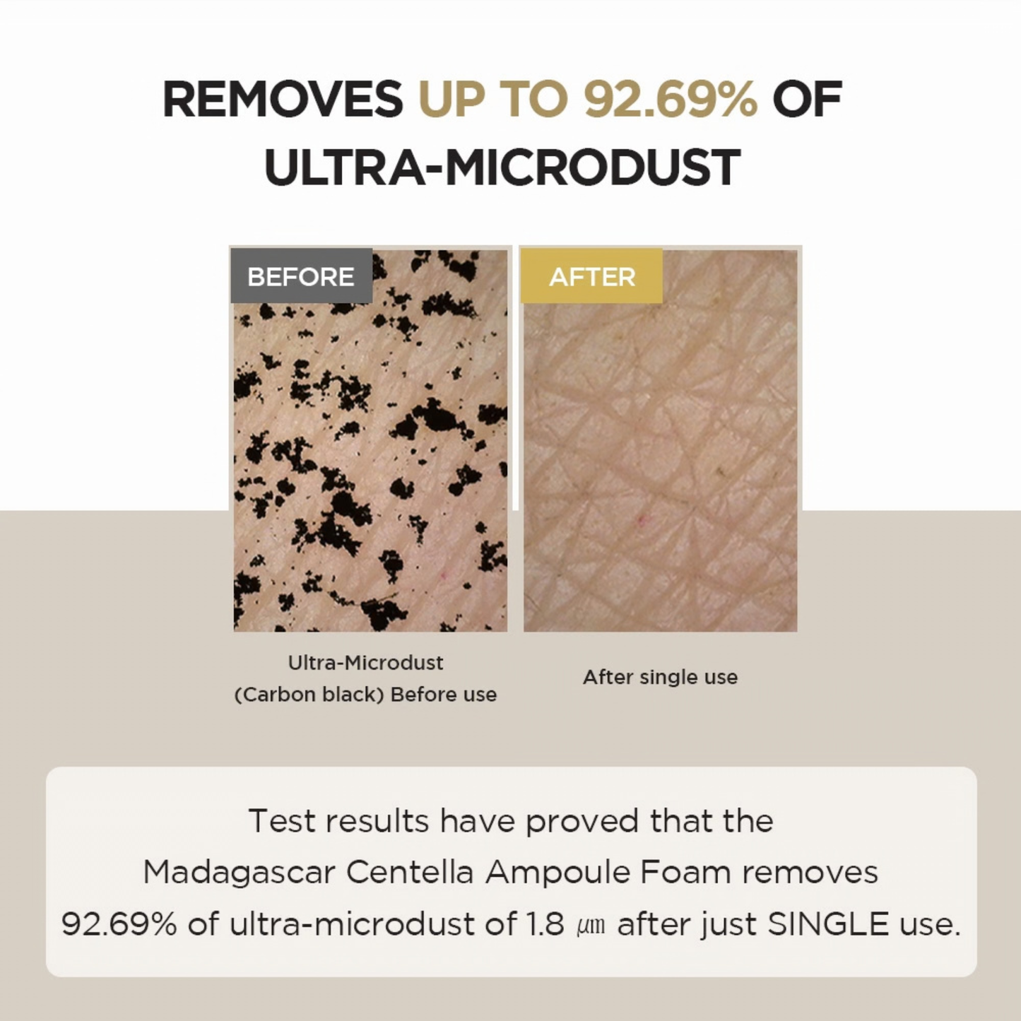 Before and after comparison of ultra-microdust removal using a SKIN1004 Madagascar Centella Ampoule Foam product.