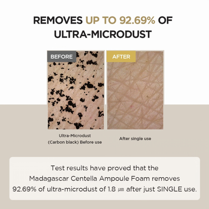 Before and after comparison of ultra-microdust removal using a SKIN1004 Madagascar Centella Ampoule Foam product.