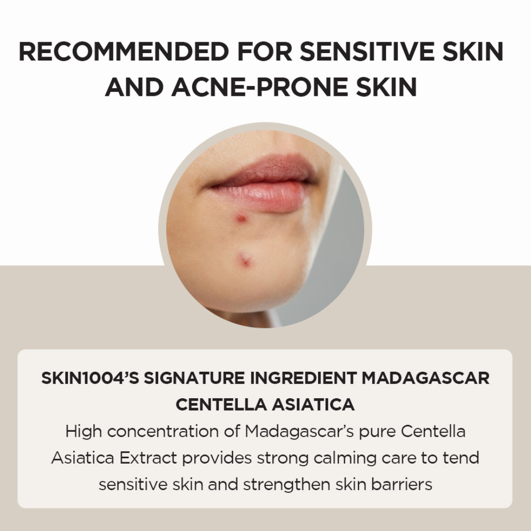 Advertisement for skincare product with a pimple on skin and text about Madagascar Centella Asiatica.