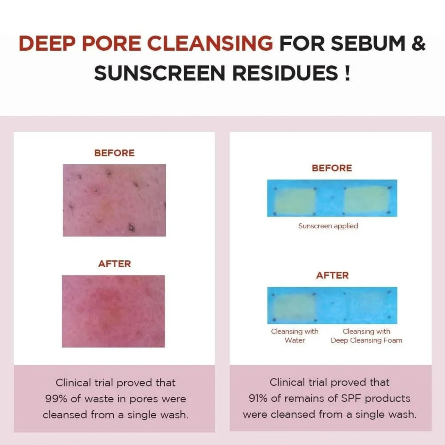 Before and after deep pore cleansing for sebum and sunscreen residues with clinical trial results after use of the SKIN1004 Madagascar Centella Poremizing Deep Cleansing Foam.