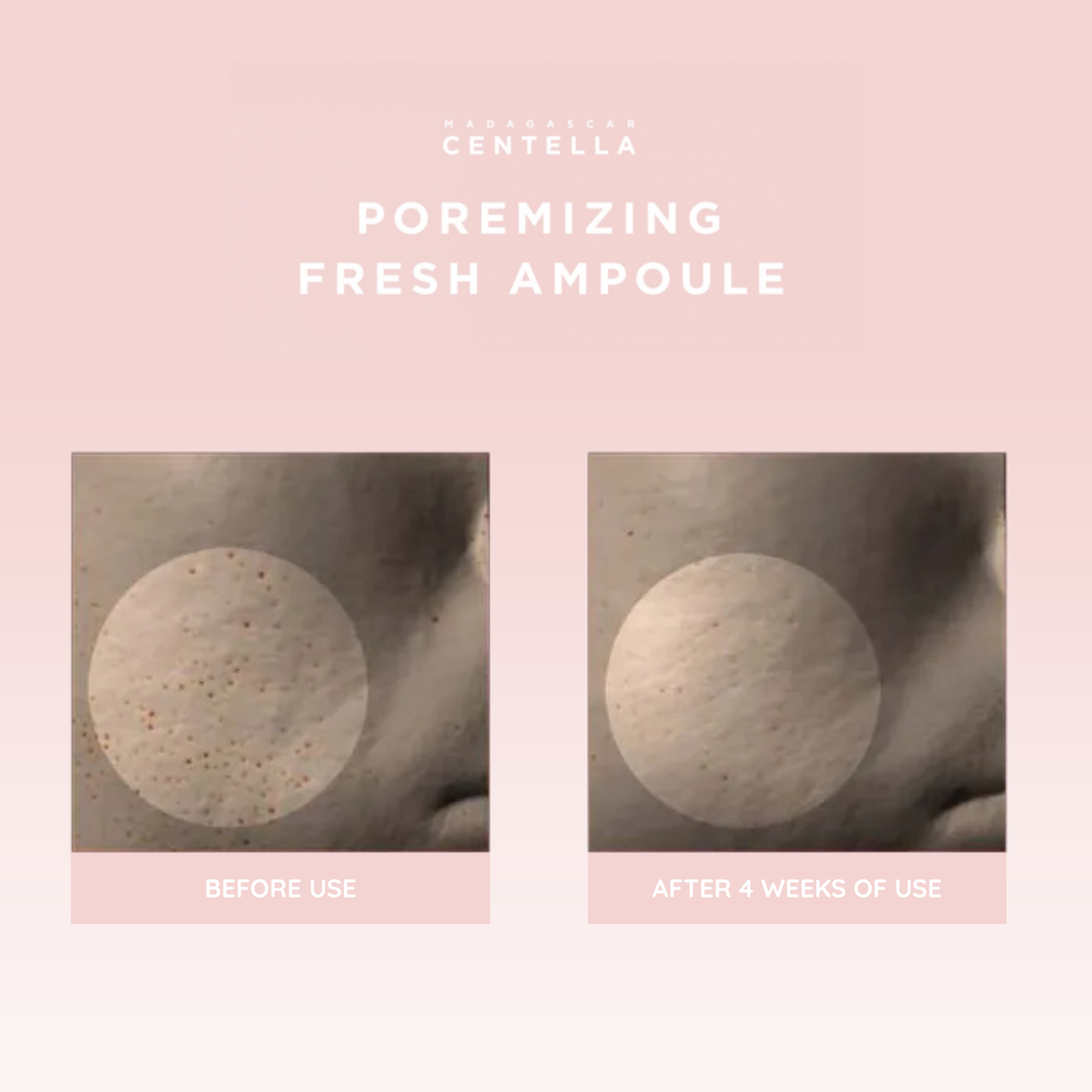 Before and after comparison of skin texture and pore size with Centella Ampoule on a pink background