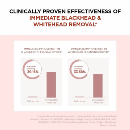 Chart showing clinically proven effectiveness of immediate blackhead and whitehead removal after the use of the SKIN1004 Madagascar Centella Poremizing Quick Clay Stick Mask on a pink background.