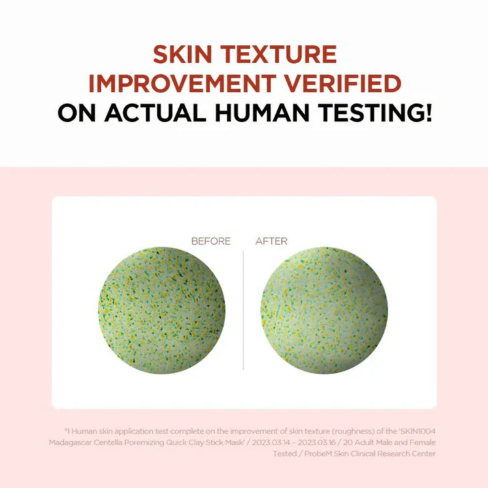 Before and after comparison of skin texture improvement after the use of SKIN1004 Madagascar Centella Poremizing Quick Clay Stick Mask on a pink background with text about human testing.