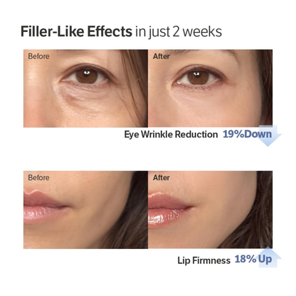 Before and after effects on on eye wrinkles and lip firmness after using the SUNGBOON EDITOR Deep Collagen Power Boosting Cream In Serum for 2 weeks.