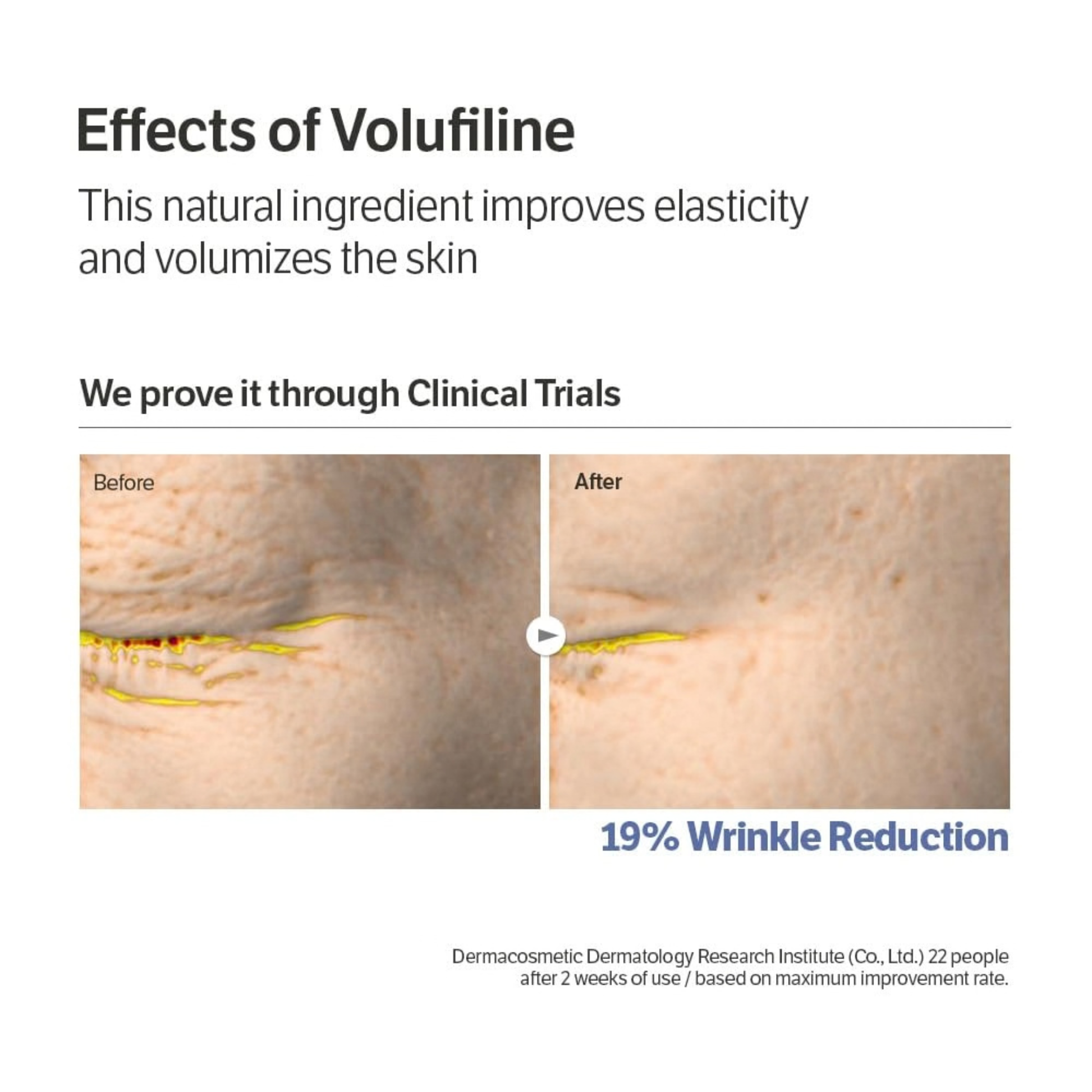 Information and images showing before and after effects on skin with wrinkle reduction after using Volufililne for two weeks in a clinical study